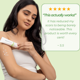 Customer testimonial for Neutriderm KS Cream, stating it has made scars barely noticeable, and praising its effectiveness.