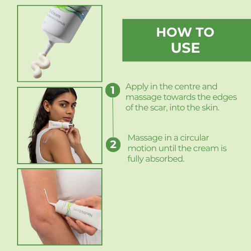 Steps for using Neutriderm KS Cream: apply to the center of the scar, massage outward in circular motions until fully absorbed. 